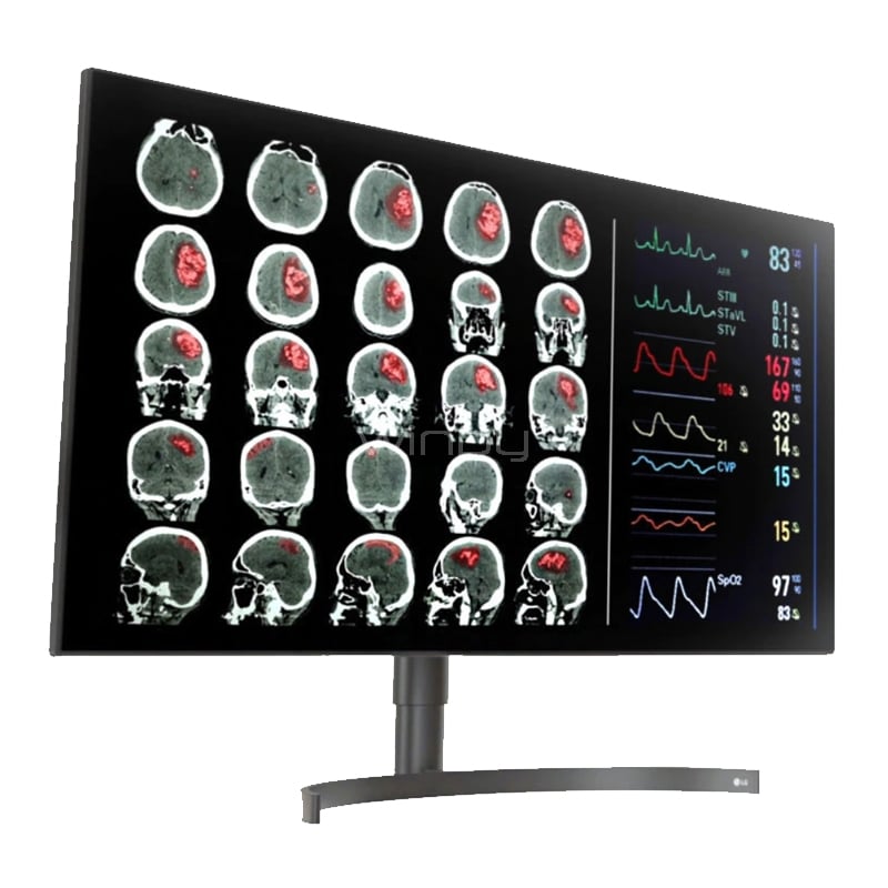 Monitor de Diagnóstico LG de 32“ (IPS, PBP / Controlador Dual, HDMI)