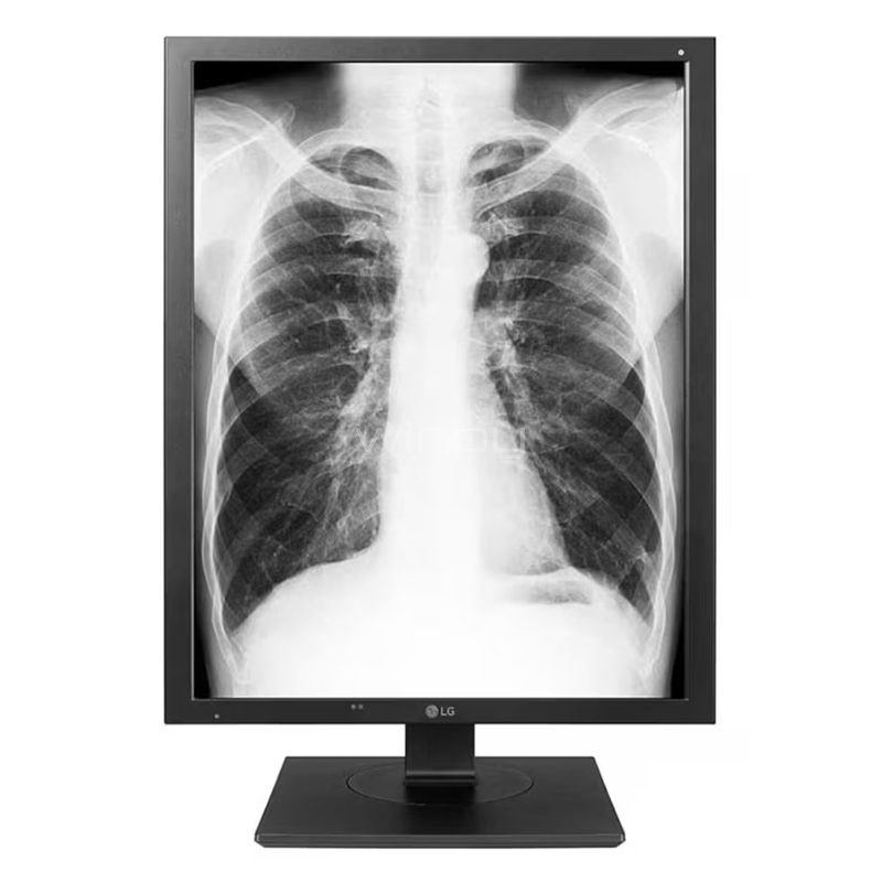 Monitor Diagnóstico LG de 21.3“ (IPS, QXGA, 3MP, DP+DVI-D, Vesa)