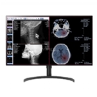 Monitor de Diagnóstico LG de 32“ (IPS, PBP / Controlador Dual, HDMI)