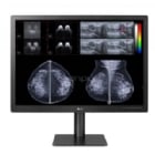 Monitor Diagnóstico LG de 31“ (IPS, 4200x2800, 12MP, Sensor de Presencia, DP+HDMI)
