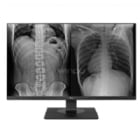 Monitor Diagnóstico LG de 27“ (IPS, 4k, 8MP, PBP, DP+HDMI)