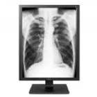 Monitor Diagnóstico LG de 21.3“ (IPS, QXGA, 3MP, DP+DVI-D, Vesa)